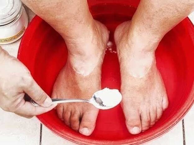 сода бани за гъбички